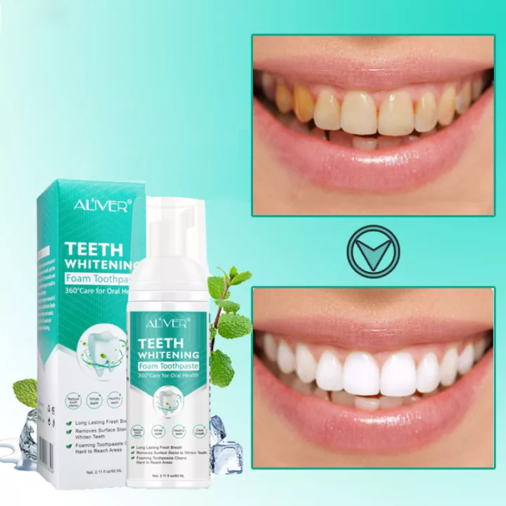 TeethWhitener™ | Zahnweiß-Schaum Zahnpasta